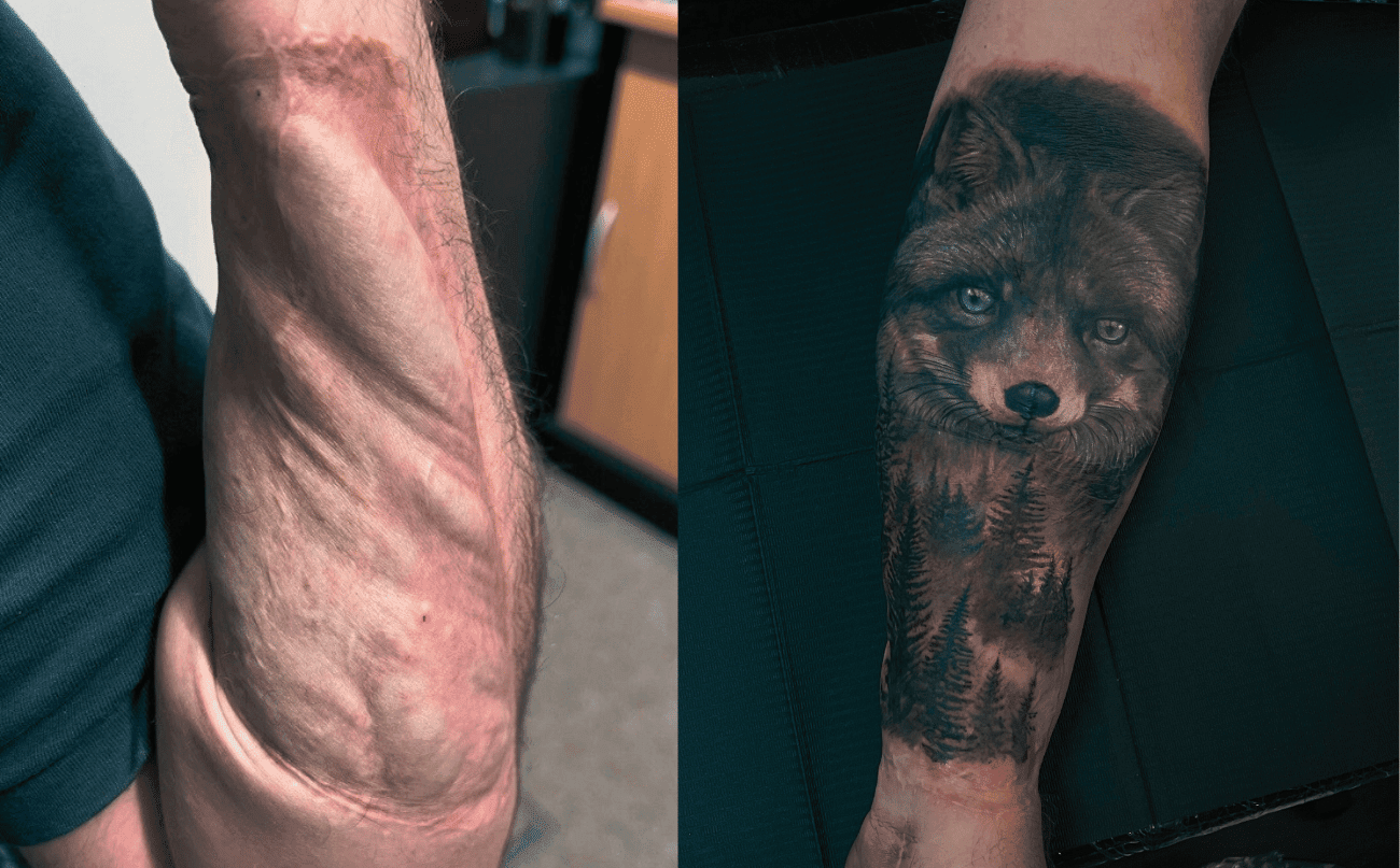 Realistische vos en bos tattoo over littekens op onderarm.